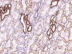 FXYD2 Polyclonal Antibody