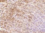 AS3MT Antibody in Immunohistochemistry (Paraffin) (IHC (P))