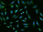 MED28 Polyclonal Antibody