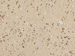 HABP4 Polyclonal Antibody