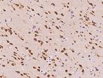 TMEM38A Antibody in Immunohistochemistry (Paraffin) (IHC (P))