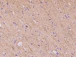 SLC6A11 Polyclonal Antibody