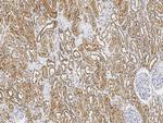 PSMD1 Polyclonal Antibody