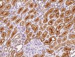 TRAK1 Polyclonal Antibody
