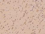 TRAK1 Antibody in Immunohistochemistry (Paraffin) (IHC (P))