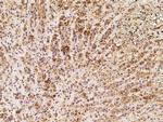 TXNDC16 Polyclonal Antibody