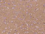 Synapsin 3 Antibody in Immunohistochemistry (Paraffin) (IHC (P))
