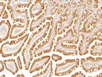 CCDC25 Antibody in Immunohistochemistry (Paraffin) (IHC (P))