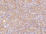 PILRB Polyclonal Antibody