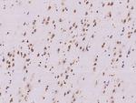 RRAGB Antibody in Immunohistochemistry (Paraffin) (IHC (P))