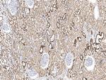 UQCRH Polyclonal Antibody