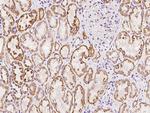 PCDH17 Polyclonal Antibody