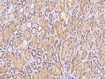 PET117 Polyclonal Antibody