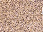 PET117 Antibody in Immunohistochemistry (Paraffin) (IHC (P))