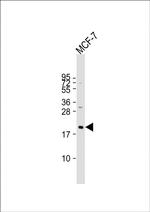 N-Ras Polyclonal Antibody
