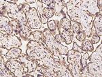 TMCC2 Polyclonal Antibody