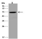 TYSND1 Polyclonal Antibody