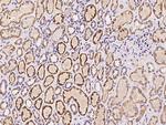 SPANXN4 Polyclonal Antibody
