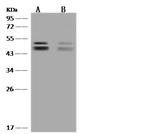 ALS2CR12 Antibody in Western Blot (WB)