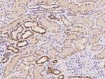 DREV Polyclonal Antibody