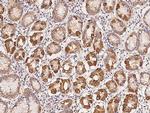SCK Polyclonal Antibody