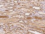 ASTL Polyclonal Antibody