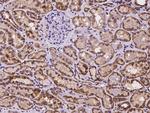 TMEM143 Polyclonal Antibody