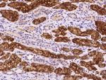 HEN2 Polyclonal Antibody