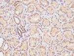 LYPD2 Polyclonal Antibody