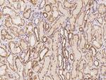 DNAH8 Polyclonal Antibody