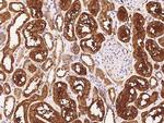 PFTK1 Polyclonal Antibody