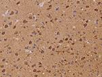 LNK Antibody in Immunohistochemistry (Paraffin) (IHC (P))