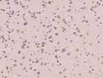 ANKS6 Antibody in Immunohistochemistry (Paraffin) (IHC (P))