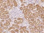 ANKS6 Polyclonal Antibody