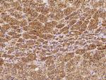 TEX264 Antibody in Immunohistochemistry (Paraffin) (IHC (P))