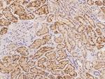 HMCN1 Antibody in Immunohistochemistry (Paraffin) (IHC (P))