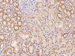 TLCD1 Polyclonal Antibody