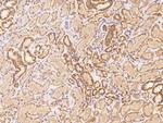 OR5V1 Polyclonal Antibody