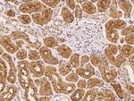 ARHGAP21 Polyclonal Antibody