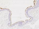CCDC114 Polyclonal Antibody