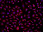 SOAT2 Antibody in Immunocytochemistry (ICC/IF)