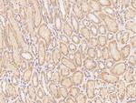 CLRN2 Polyclonal Antibody