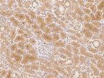 NIPAL2 Polyclonal Antibody