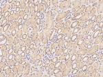 OTOP1 Polyclonal Antibody