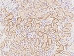 FER1L6 Polyclonal Antibody