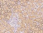 C17orf99 Polyclonal Antibody