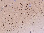 ZDHHC12 Antibody in Immunohistochemistry (Paraffin) (IHC (P))
