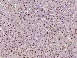 ZDHHC12 Antibody in Immunohistochemistry (Paraffin) (IHC (P))