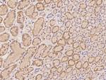 HRASLS Antibody in Immunohistochemistry (Paraffin) (IHC (P))