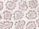 ZNF354C Polyclonal Antibody